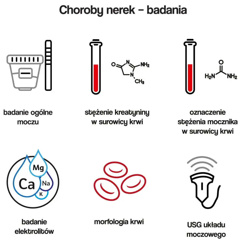 Ciche zagrożenie nerek: jakie badania wykonać i jak im zapobiegać?