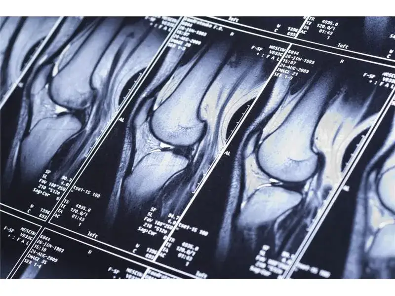 Ile się czeka na rezonans NFZ? Sprawdź aktualne czasy oczekiwania