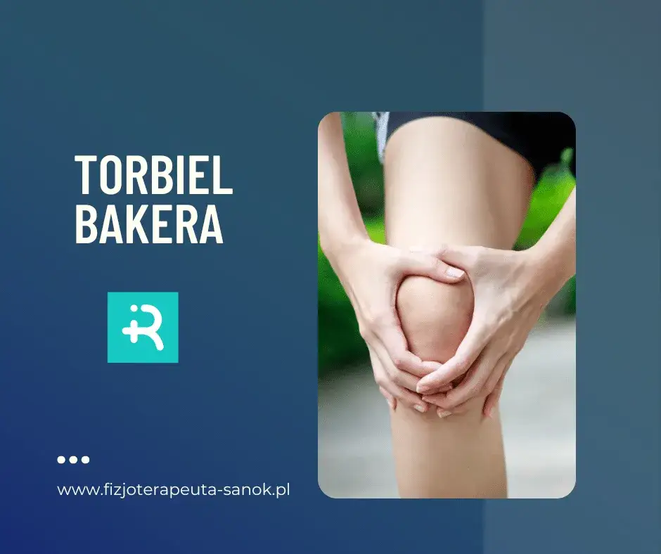 Najskuteczniejsze leki na torbiel Bakera - sprawdzone metody leczenia