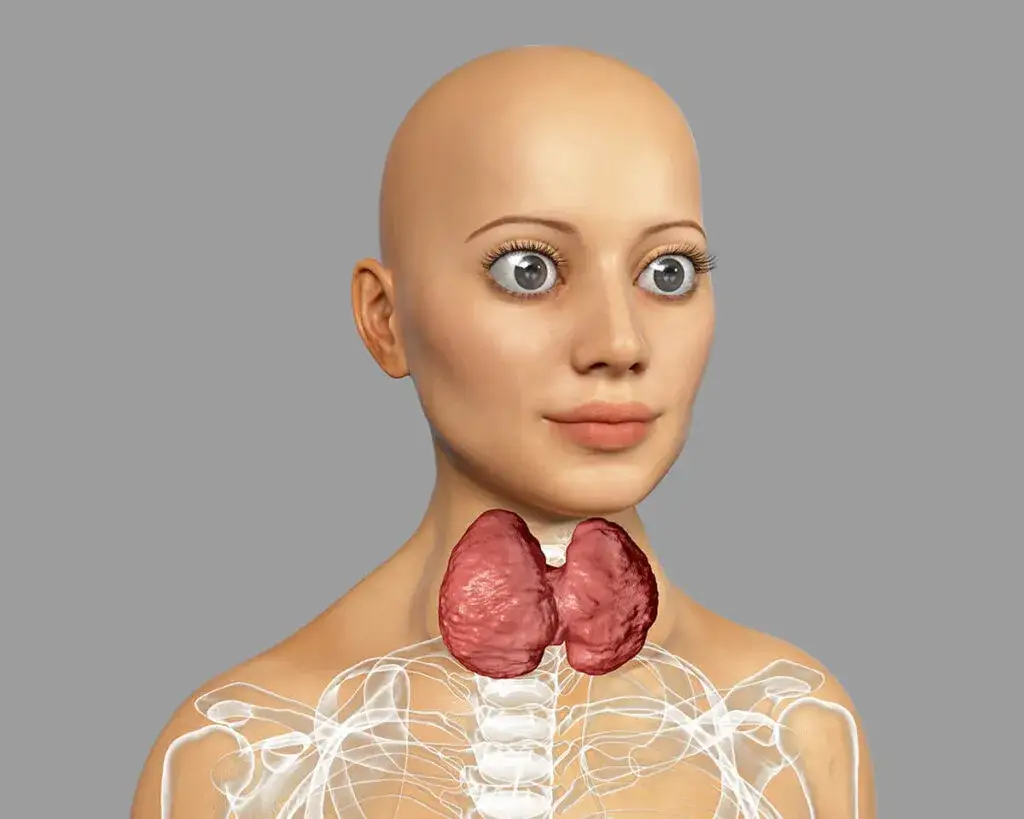 Gravesa-Basedowa: Objawy, których nie możesz ignorować