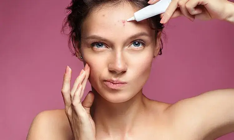 Jak pozbyć się pryszczy podskórnych? Domowe sposoby i dermatolog