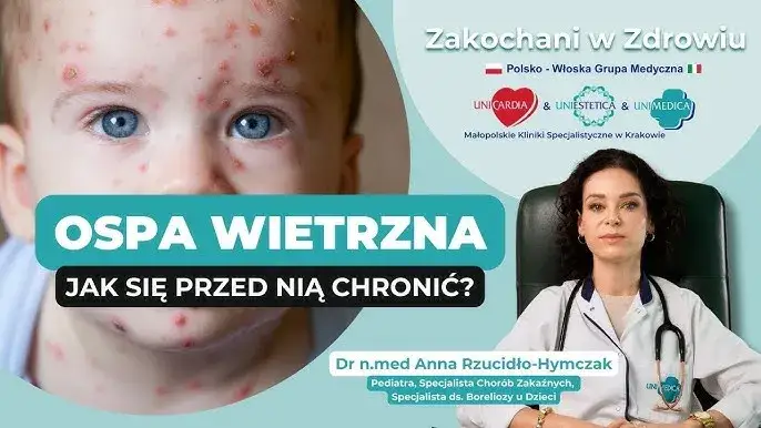 Ospa wietrzna: miałeś kontakt? Sprawdź, jak się chronić!