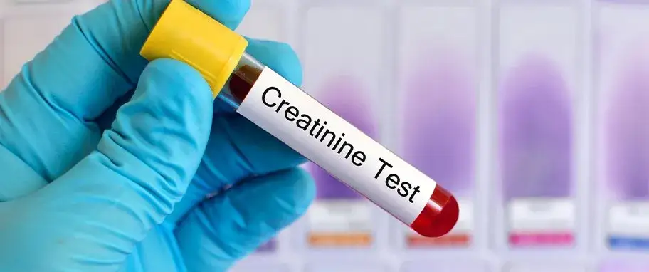 Kreatynina: przygotowanie do badania. Wyniki bez fałszu!