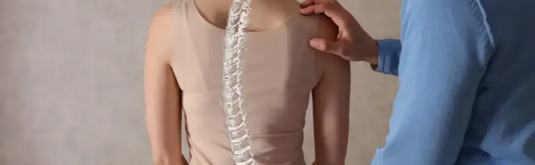 Skolioza: Ćwiczenia, które leczą, i te, których musisz unikać