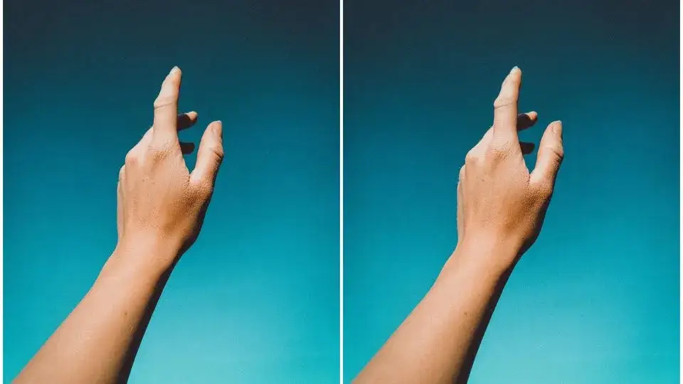 Syndrom obcej ręki: Co to jest? Objawy, przyczyny, leczenie