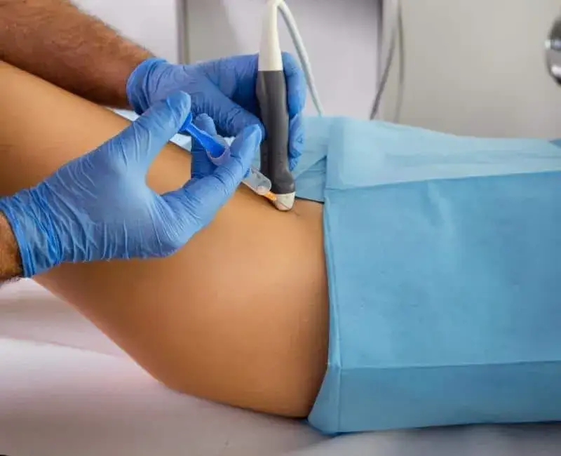 Czy to skręcenie biodra? Objawy, leczenie i kiedy do lekarza