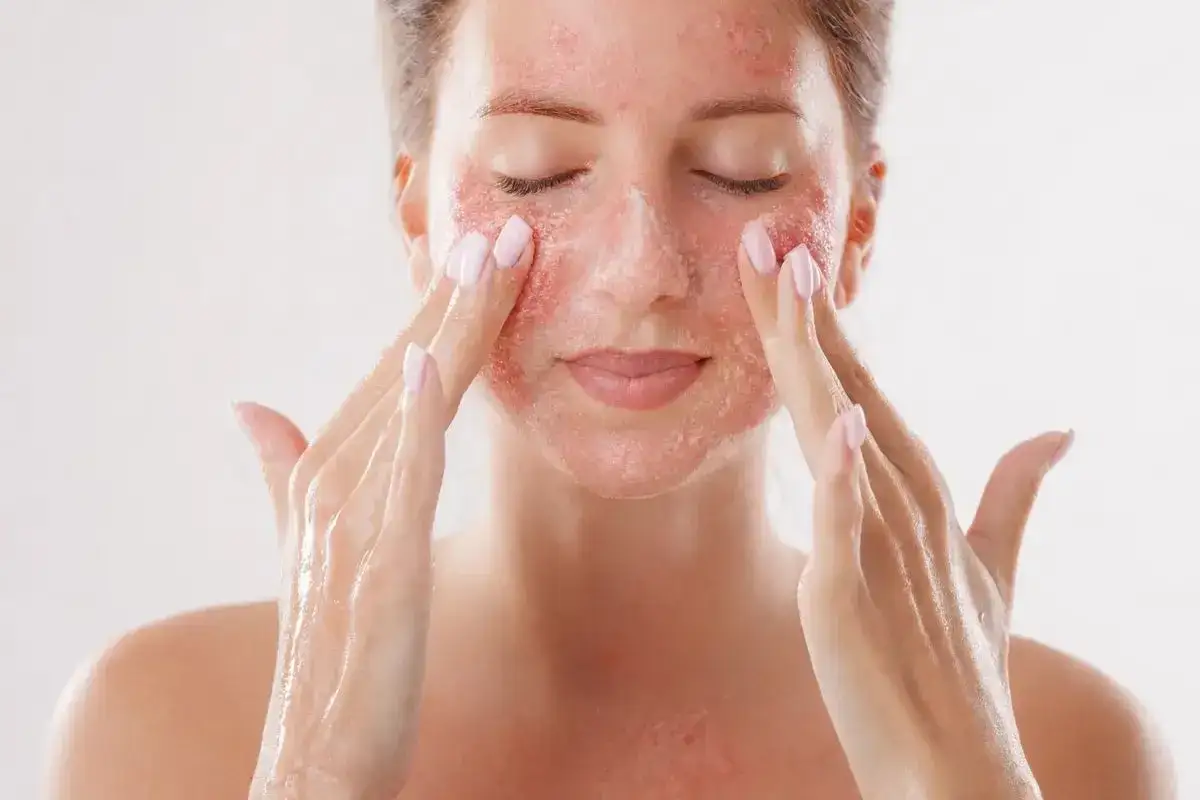 Kobieta z zaczerwienioną skórą twarzy, która może być efektem wysypu po retinolu, delikatnie masuje policzki.