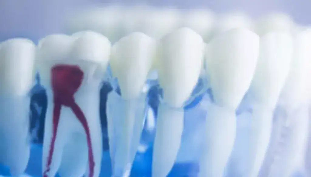 Ile kanałów ma dolna szóstka? Klucz do skutecznego leczenia.