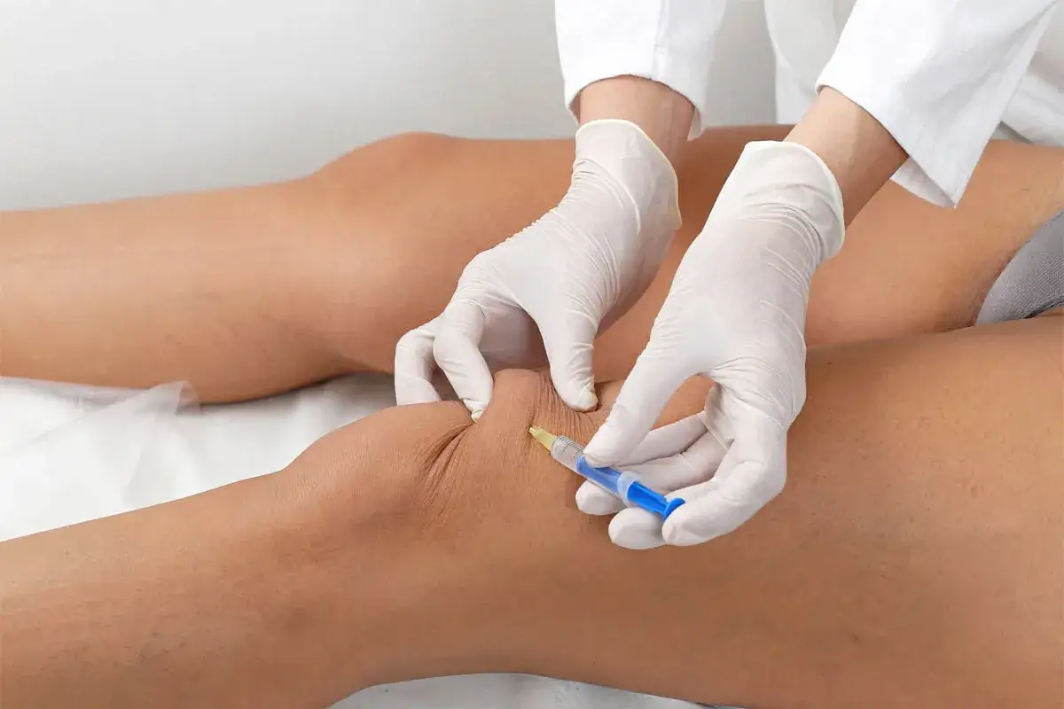 Lekarz wykonuje zastrzyk w kolano z kwasu hialuronowego, aby złagodzić ból i poprawić ruchomość stawu.