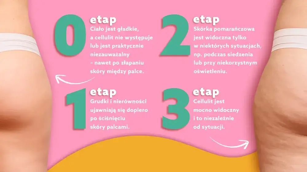 Cellulit: Moja sprawdzona strategia, która odmieniła moje ciało
