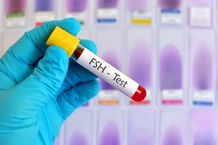 Ile kosztuje badanie FSH? Ceny, NFZ i jak zaoszczędzić!