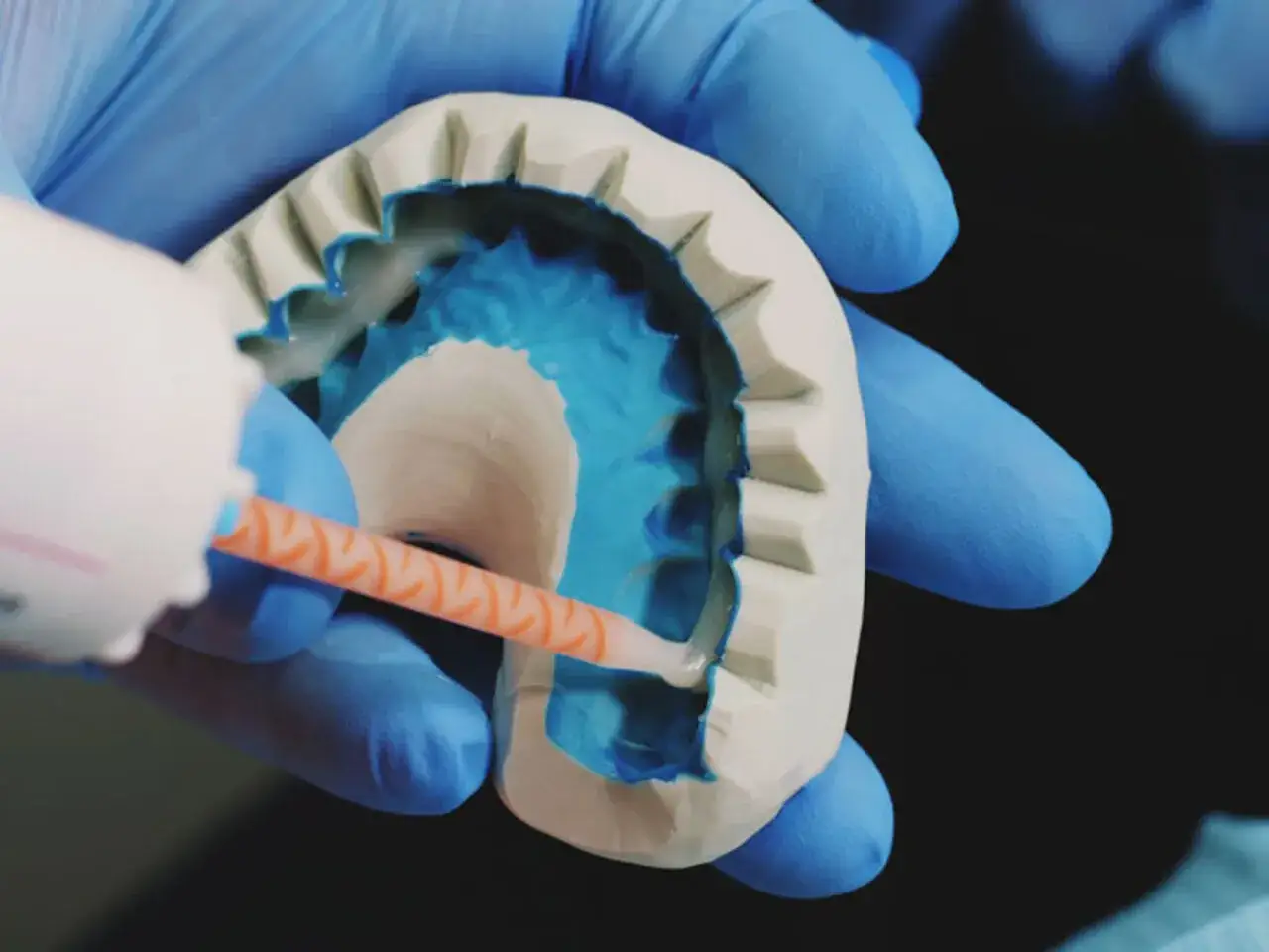 Pęknięta proteza zębowa? Apteczny klej, ale unikaj Super Glue!