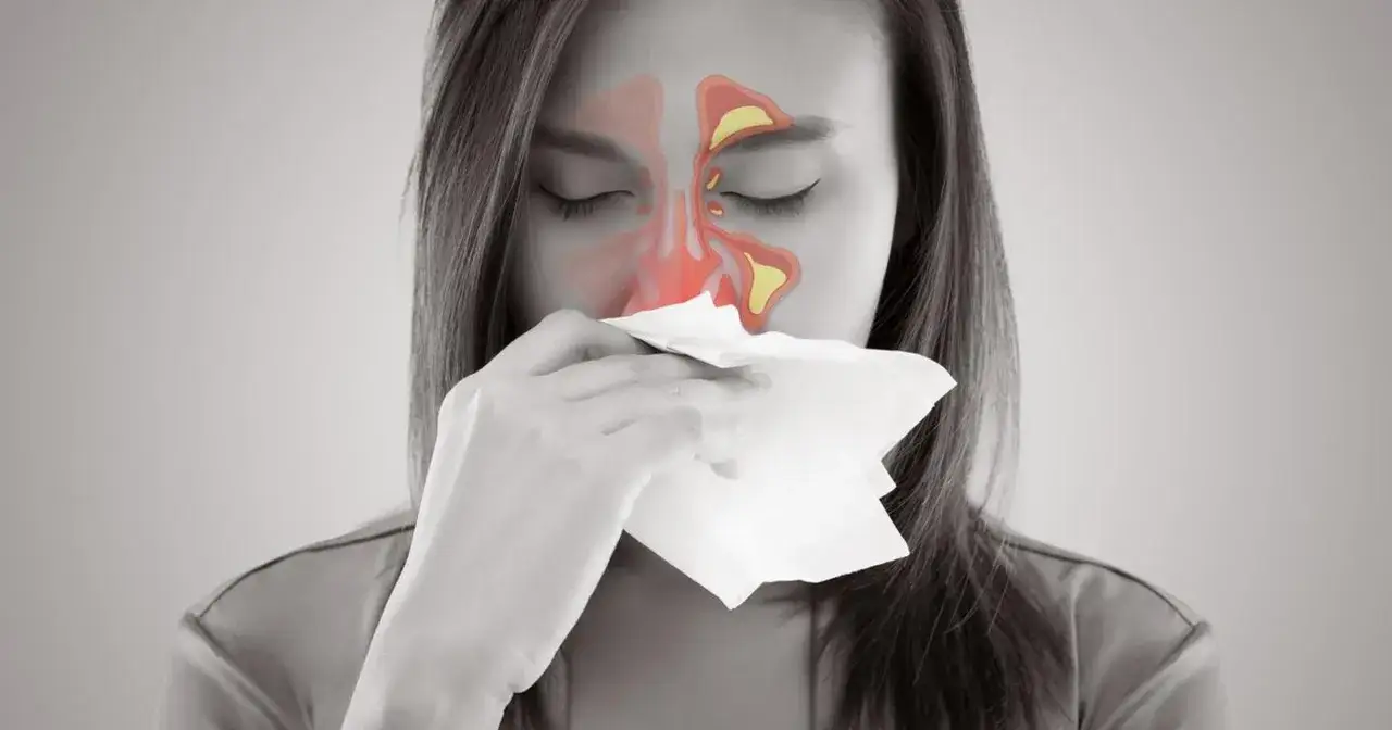 Kobieta z zatkanymi zatokami objawy: ból głowy, katar i uczucie zatkania. Ilustracja pokazuje stan zapalny zatok.