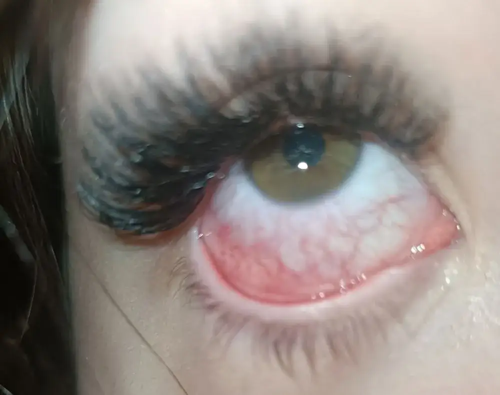 Czerwone oczy po założeniu rzęs? Sprawdź, jak to złagodzić i uniknąć bólu