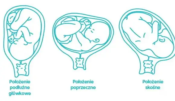 Kiedy płód układa się do porodu i co to oznacza dla mamy?