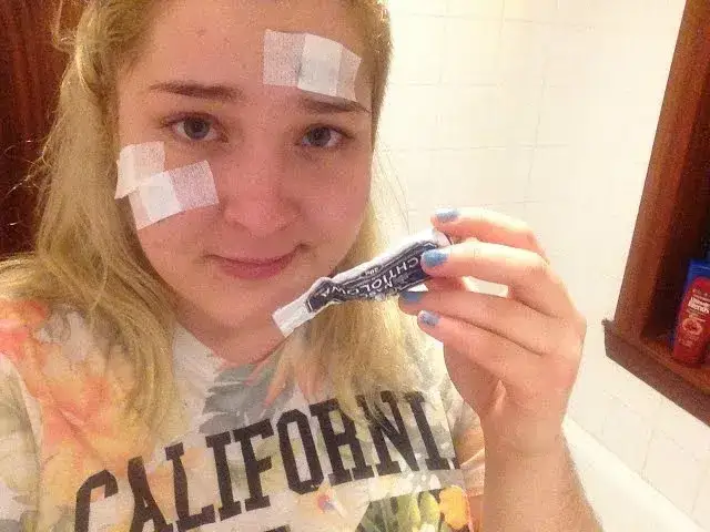 Maść ichtiolowa na pryszcze: Apteczny hit czy mit? Pełny poradnik