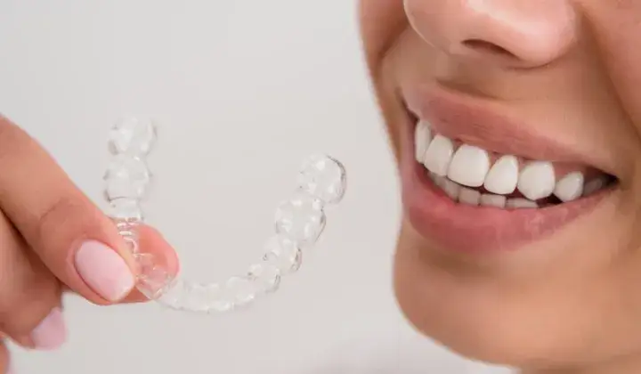 Szyna na zęby: Wygląd, typy i sekret idealnego dopasowania