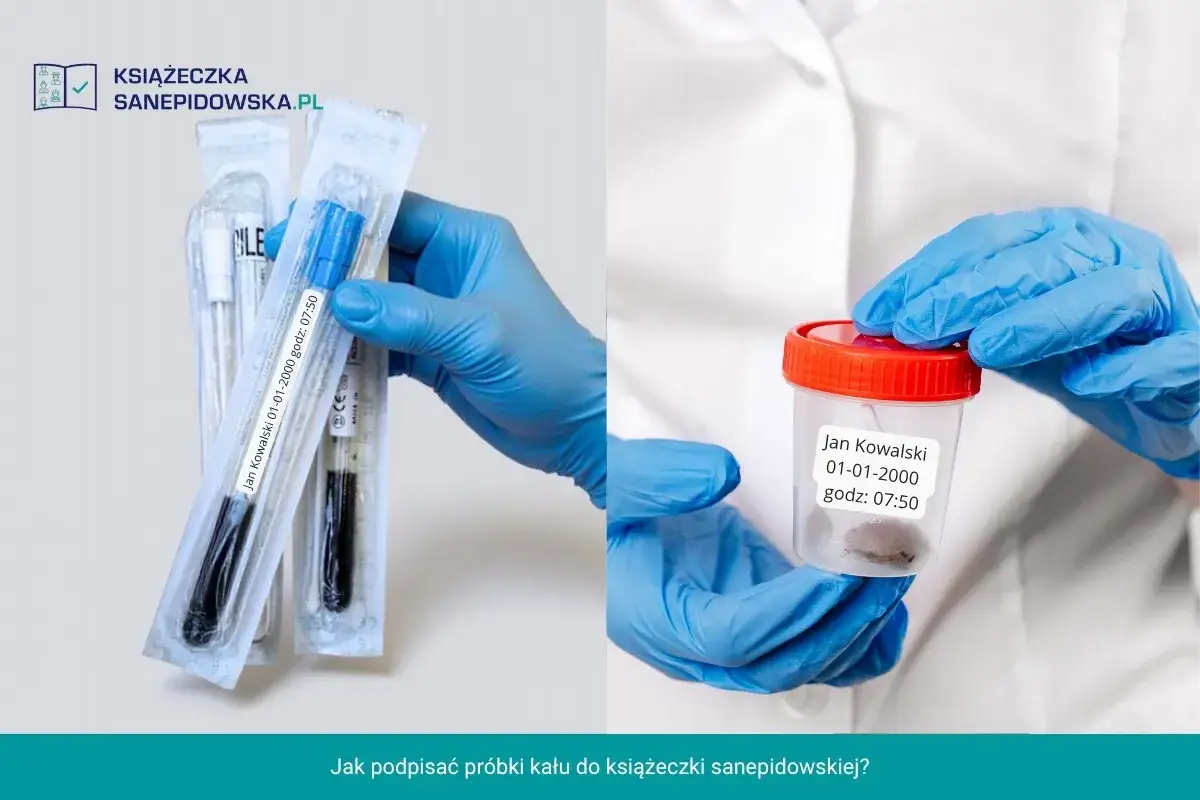 Badanie kału do sanepidu: Bezterminowe? Kiedy musisz je powtórzyć?