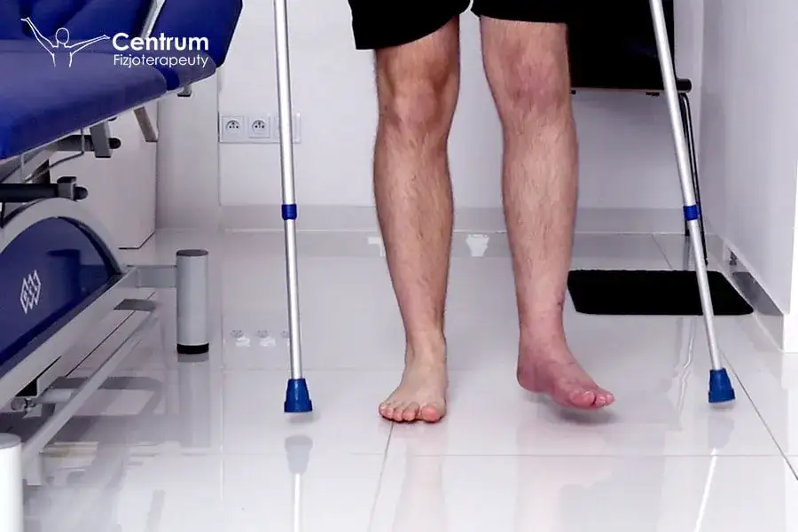 Rehabilitacja po złamaniu kostki bocznej: Ćwiczenia i powrót do formy