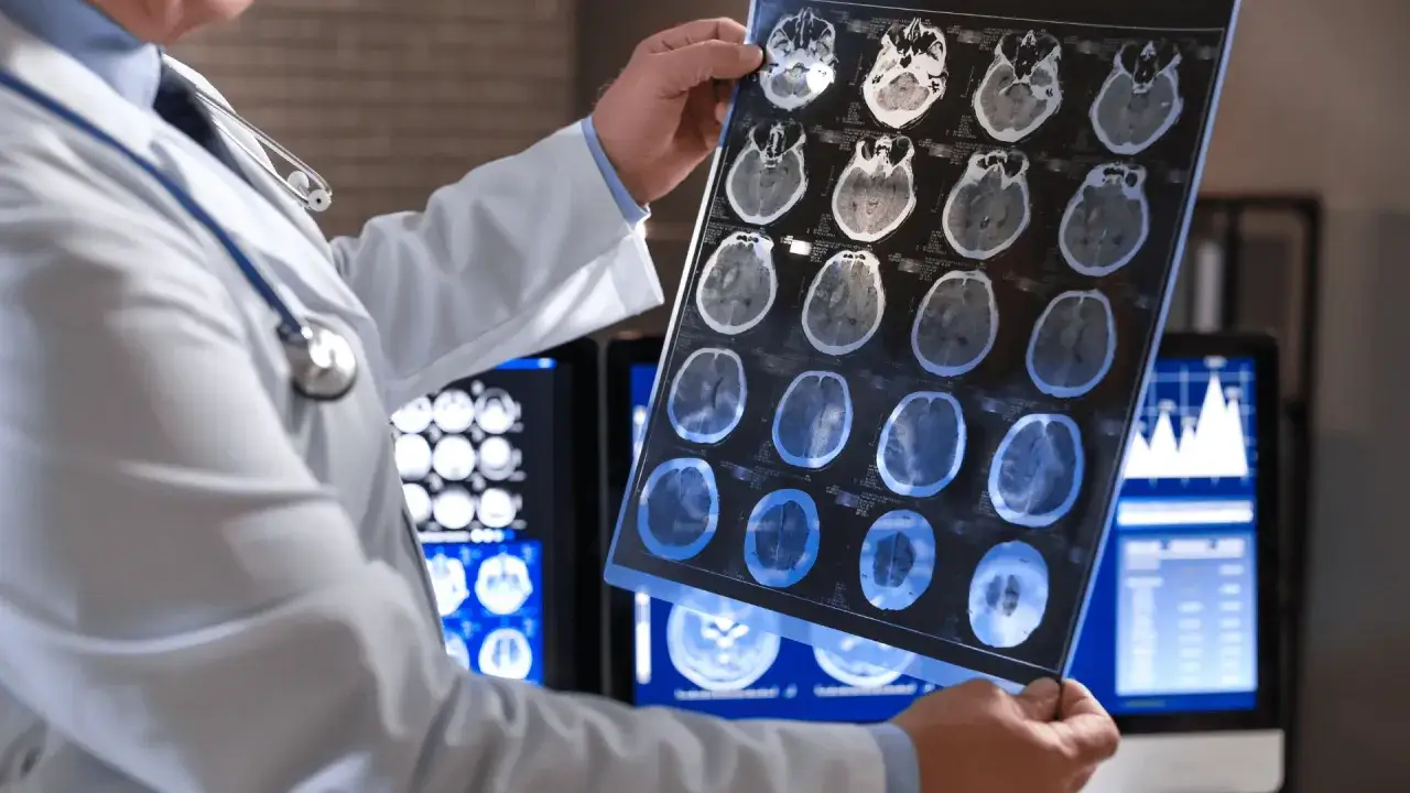 Z jakimi objawami do neurologa? Sprawdź, kiedy działać!