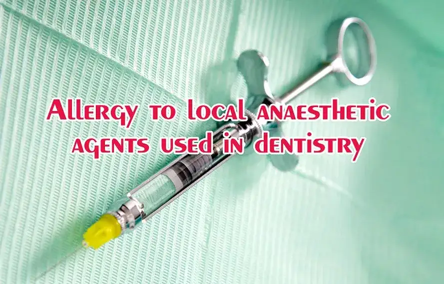 Objawy uczulenia na znieczulenie u dentysty – jak rozpoznać i zapobiec reakcji alergicznej