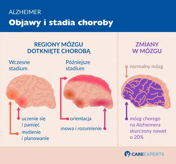 Choroby neurodegeneracyjne: Objawy, które musisz znać.