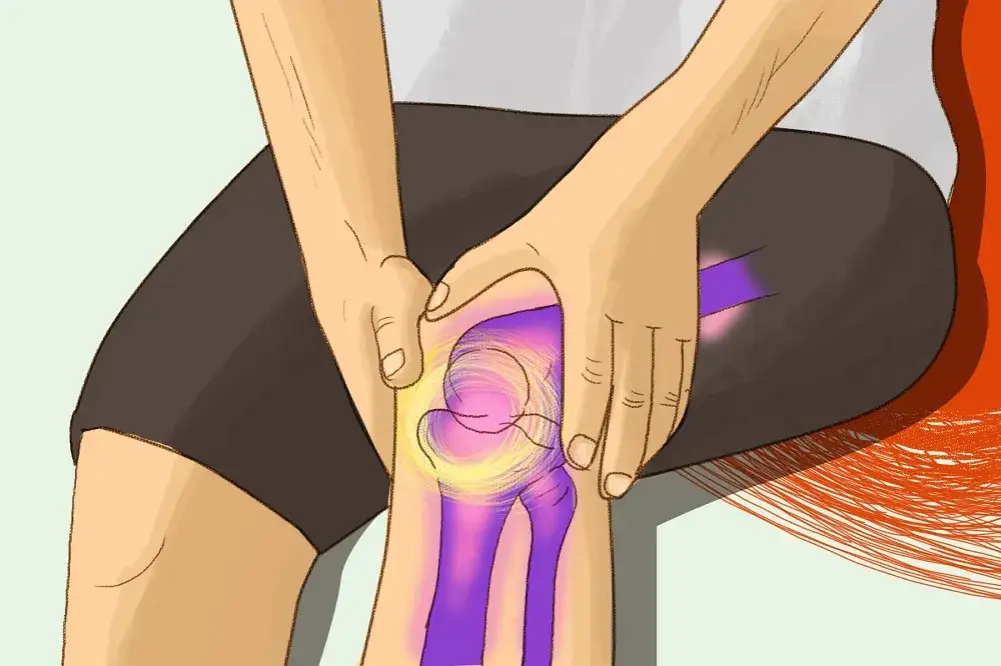 Skręcenie kolana: Czy można chodzić? Stopnie urazu i pierwsza pomoc