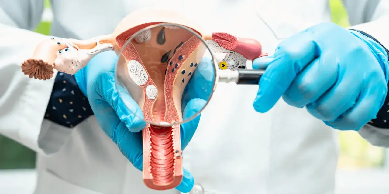 Pierwsza miesiączka po histeroskopii: Co jest normą, a co niepokoi?