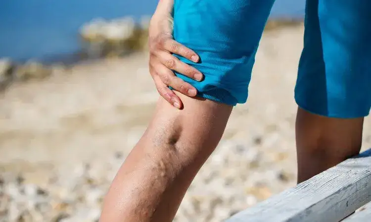 Jakie leki na zakrzepicę nóg pomogą uniknąć poważnych problemów?