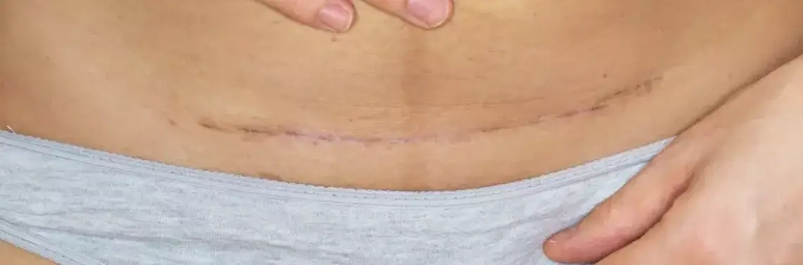 Czy cięcie się to grzech? Zrozumienie moralnych i duchowych aspektów