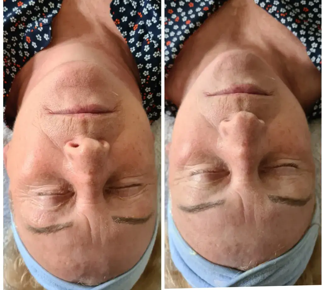 Masaż twarzy: efekty po tygodniu i miesiącu. Jak zacząć?