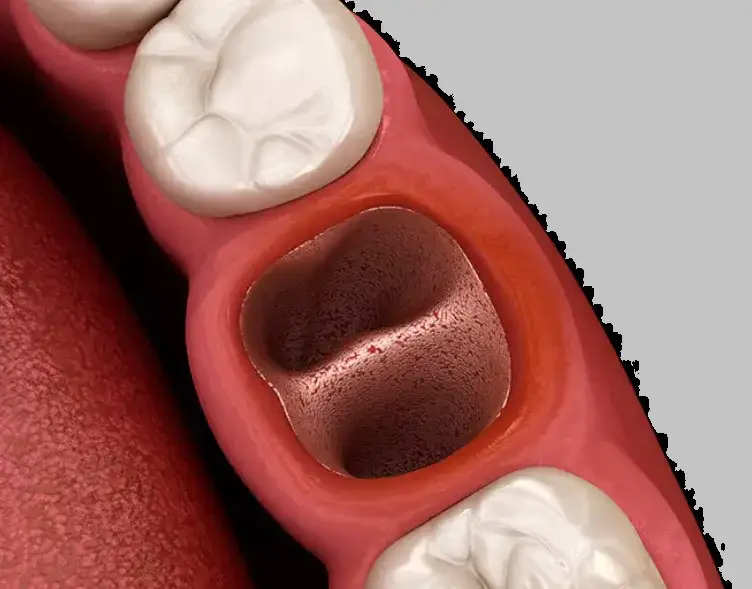 Ile krwawi dziąsło po wyrwaniu zęba? Sprawdź, co jest normalne