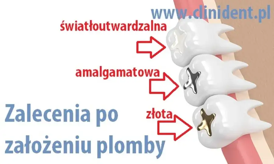 Palenie po wizycie u dentysty: Kiedy jest bezpieczne?