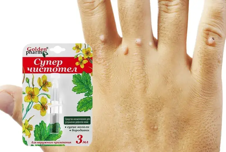 Skuteczne leki na włókniaki: uniknij bólu i podrażnień