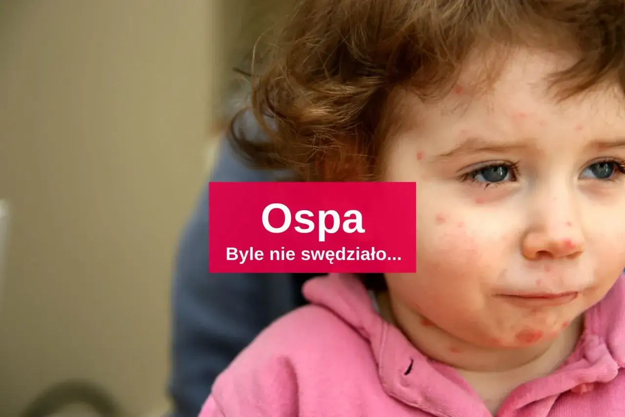 Skuteczne leki na ospe - jak złagodzić objawy i przyspieszyć leczenie