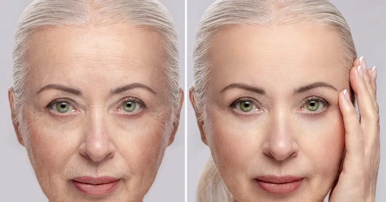 Kremy z efektem flash: Szybkie wygładzenie zmarszczek przed wyjściem