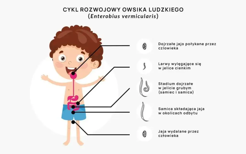 Skąd się biorą owsiki i jak uniknąć zarażenia nimi?