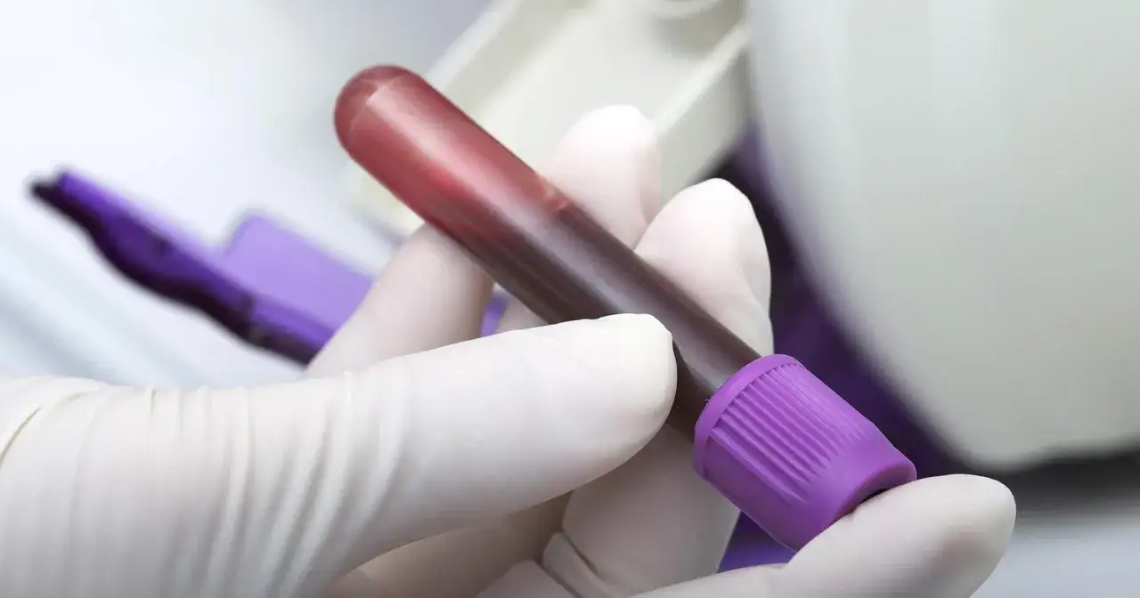 Fibrynogen - co to za badanie i jakie ma znaczenie dla zdrowia?