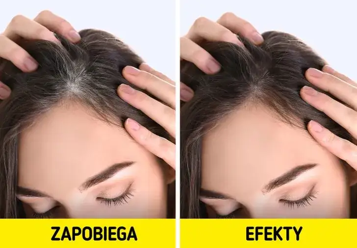 Jak zapobiec siwieniu włosów – skuteczne metody i naturalne sposoby na młodszy wygląd