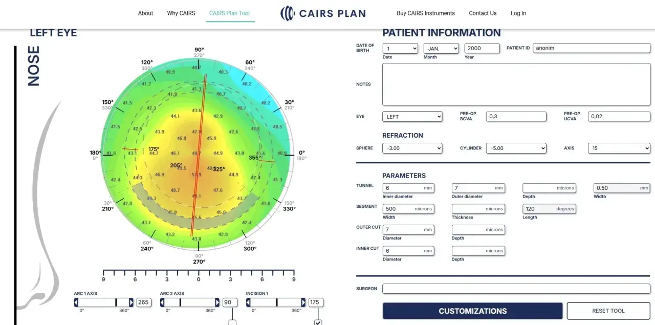 Jak leczyć wady wzroku? Skuteczne metody i ich koszty