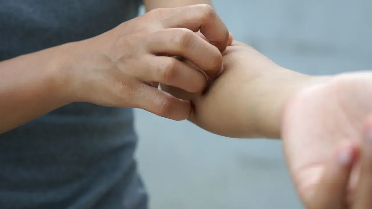 Schnelle Hilfe gegen Flöhe in der Wohnung: Effektive Sofortmaßnahmen