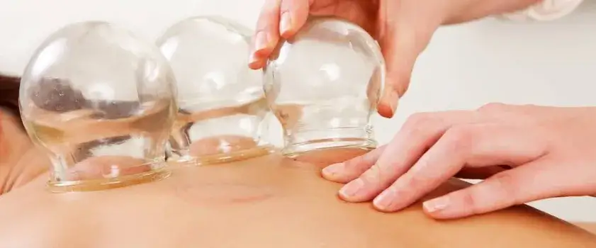 Stawianie baniek: Kompletny poradnik domowej terapii krok po kroku