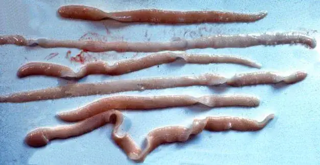 Jakie badania na tasiemca są najskuteczniejsze? Sprawdź, jak wykryć pasożyta!