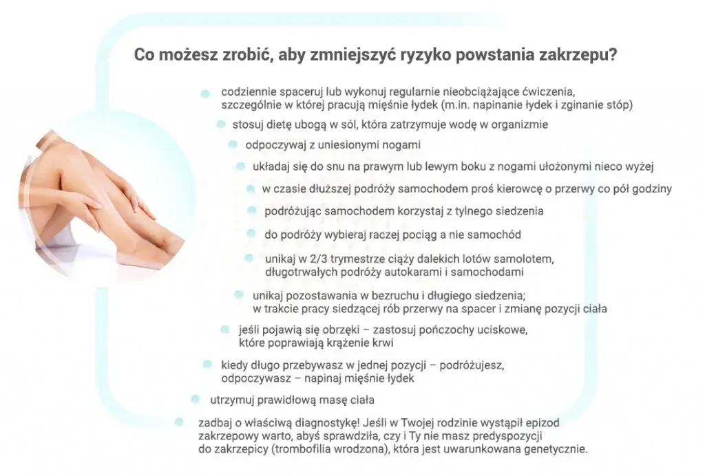 Jak zapobiec zakrzepicy: skuteczne metody i proste zmiany w stylu życia