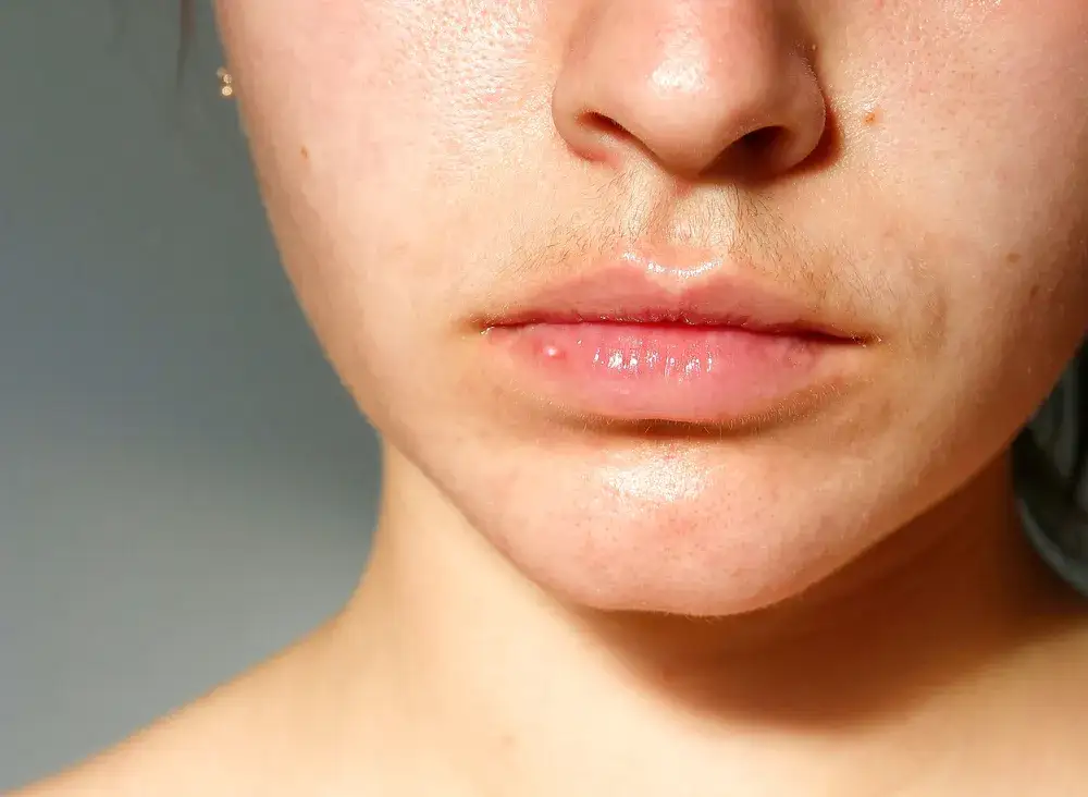 Jak skutecznie usunąć damski wąsik i uniknąć podrażnień skóry?