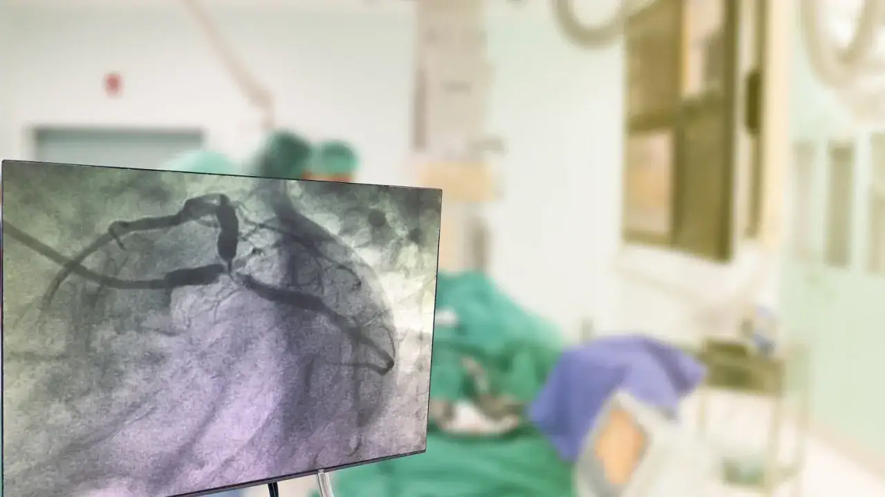 Alkohol po koronarografii: Czy jest bezpieczny dla Twojego serca?