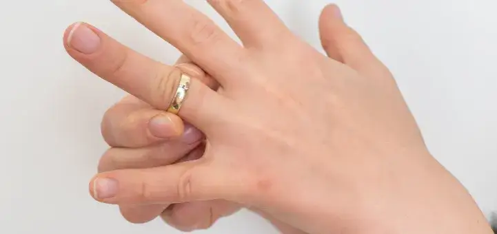 Obrączka utknęła na spuchniętym palcu? 5 domowych sposobów!