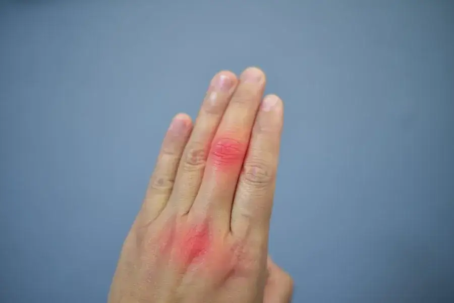 Kwas moczowy jakie badanie: jak przygotować się i co oznacza wynik