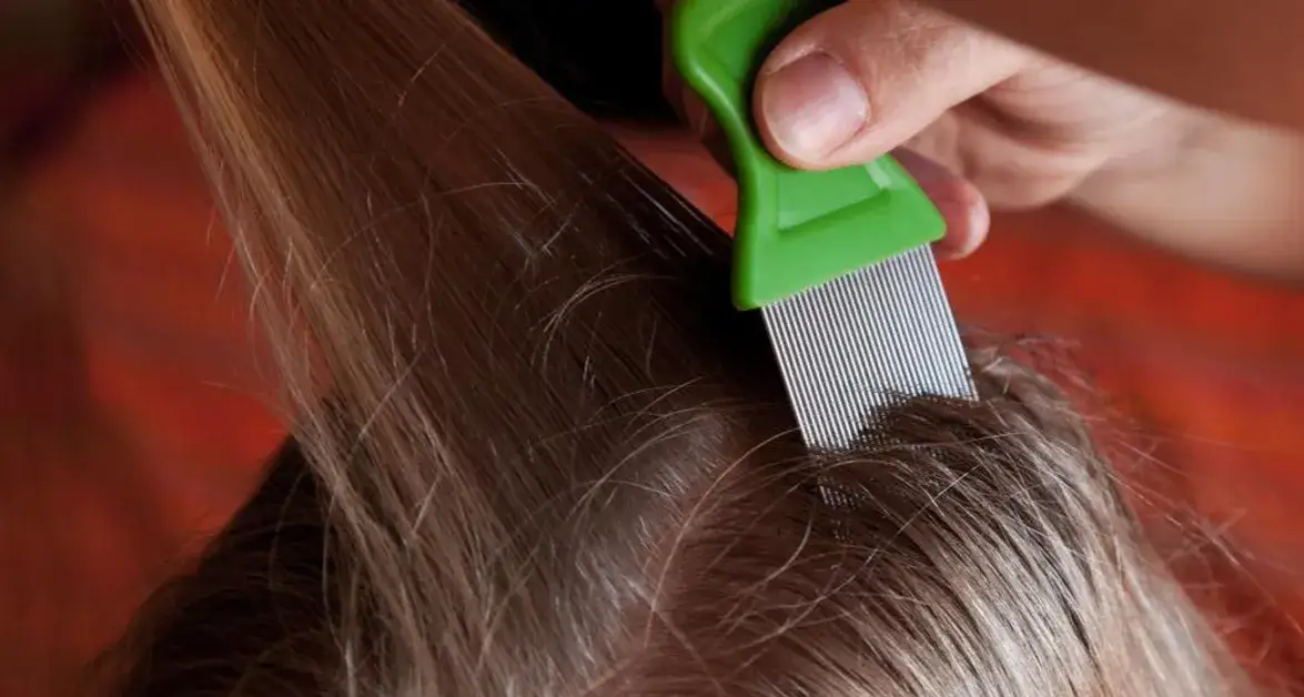 Jak walczyć z wszami u dziecka: skuteczne metody i porady na każdą sytuację