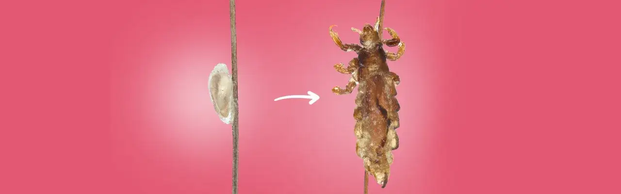 Jak się rozmnażają wszy? Poznaj ich cykl życia i jak ich unikać